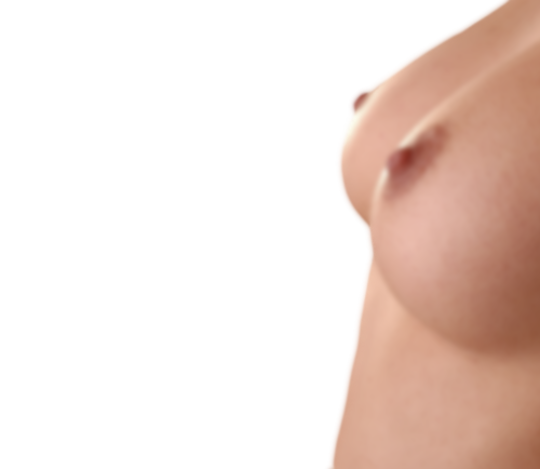 Breast enlargement