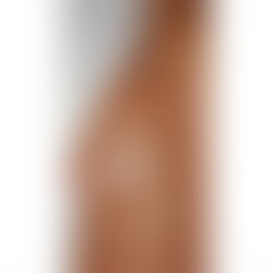 Vorher